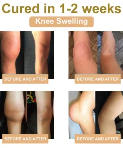 𝑹𝒂𝒊𝒏𝒅𝒆𝒘® 𝑩𝑬𝑬 𝑽𝑬𝑵𝑶𝑴 𝑱𝑶𝑰𝑵𝑻 𝑹𝑬𝑳𝑰𝑬𝑭 𝑩𝑨𝑳𝑴