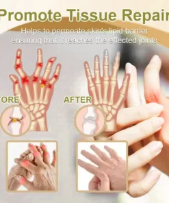 𝑹𝒂𝒊𝒏𝒅𝒆𝒘® 𝑩𝑬𝑬 𝑽𝑬𝑵𝑶𝑴 𝑱𝑶𝑰𝑵𝑻 𝑹𝑬𝑳𝑰𝑬𝑭 𝑩𝑨𝑳𝑴