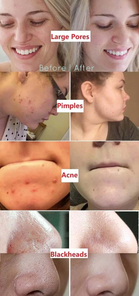 Grevéa™ Green Tea Deep Cleanse Mask Stick