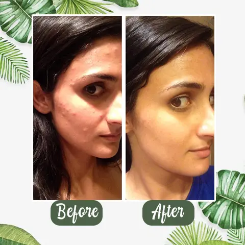 Grevéa™ Green Tea Deep Cleanse Mask Stick