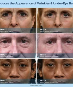 Plexadern™ 60-Second Anti-Aging Serum