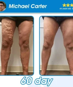 RAINDEW® GLP-1 Slimming & Health Ultra Concentrated Essence Liquid Pearls