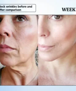 ϹΟRΟU® Nano Microneedle Wrinkle Patch