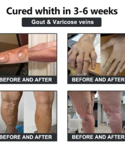 𝐕𝐢𝐨𝐫𝐚𝐥𝐢𝐟𝐞𝐬™ 𝐁𝐞𝐞 𝐕𝐞𝐧𝐨𝐦 𝐚𝐧𝐝 𝐓𝐮𝐫𝐦𝐞𝐫𝐢𝐜 𝐉𝐨𝐢𝐧𝐭 𝐚𝐧𝐝 𝐁𝐨𝐧𝐞 𝐏𝐚𝐢𝐧 𝐑𝐞𝐥𝐢𝐞𝐟 𝐂𝐫𝐞𝐚𝐦