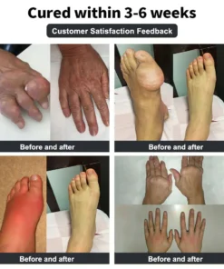 𝐕𝐢𝐨𝐫𝐚𝐥𝐢𝐟𝐞𝐬™ 𝐁𝐞𝐞 𝐕𝐞𝐧𝐨𝐦 𝐚𝐧𝐝 𝐓𝐮𝐫𝐦𝐞𝐫𝐢𝐜 𝐉𝐨𝐢𝐧𝐭 𝐚𝐧𝐝 𝐁𝐨𝐧𝐞 𝐏𝐚𝐢𝐧 𝐑𝐞𝐥𝐢𝐞𝐟 𝐂𝐫𝐞𝐚𝐦