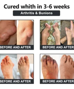 𝐕𝐢𝐨𝐫𝐚𝐥𝐢𝐟𝐞𝐬™ 𝐁𝐞𝐞 𝐕𝐞𝐧𝐨𝐦 𝐚𝐧𝐝 𝐓𝐮𝐫𝐦𝐞𝐫𝐢𝐜 𝐉𝐨𝐢𝐧𝐭 𝐚𝐧𝐝 𝐁𝐨𝐧𝐞 𝐏𝐚𝐢𝐧 𝐑𝐞𝐥𝐢𝐞𝐟 𝐂𝐫𝐞𝐚𝐦