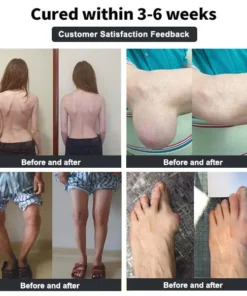 𝐕𝐢𝐨𝐫𝐚𝐥𝐢𝐟𝐞𝐬™ 𝐁𝐞𝐞 𝐕𝐞𝐧𝐨𝐦 𝐚𝐧𝐝 𝐓𝐮𝐫𝐦𝐞𝐫𝐢𝐜 𝐉𝐨𝐢𝐧𝐭 𝐚𝐧𝐝 𝐁𝐨𝐧𝐞 𝐏𝐚𝐢𝐧 𝐑𝐞𝐥𝐢𝐞𝐟 𝐂𝐫𝐞𝐚𝐦