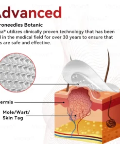 𝑉𝑠𝑜𝑥𝑎® 𝑀𝑖𝑐𝑟𝑜𝑛𝑒𝑒𝑑𝑙𝑒𝑠 𝐵𝑜𝑡𝑎𝑛𝑖𝑐 𝑆𝑘𝑖𝑛 𝑇𝑎𝑔𝑠 𝑆𝑜𝑙𝑢𝑡𝑖𝑜𝑛 𝑃𝑎𝑡𝑐ℎ𝑒𝑠