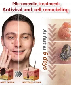 𝑉𝑠𝑜𝑥𝑎® 𝑀𝑖𝑐𝑟𝑜𝑛𝑒𝑒𝑑𝑙𝑒𝑠 𝐵𝑜𝑡𝑎𝑛𝑖𝑐 𝑆𝑘𝑖𝑛 𝑇𝑎𝑔𝑠 𝑆𝑜𝑙𝑢𝑡𝑖𝑜𝑛 𝑃𝑎𝑡𝑐ℎ𝑒𝑠