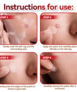 𝑉𝑠𝑜𝑥𝑎® 𝑀𝑖𝑐𝑟𝑜𝑛𝑒𝑒𝑑𝑙𝑒𝑠 𝐵𝑜𝑡𝑎𝑛𝑖𝑐 𝑆𝑘𝑖𝑛 𝑇𝑎𝑔𝑠 𝑆𝑜𝑙𝑢𝑡𝑖𝑜𝑛 𝑃𝑎𝑡𝑐ℎ𝑒𝑠