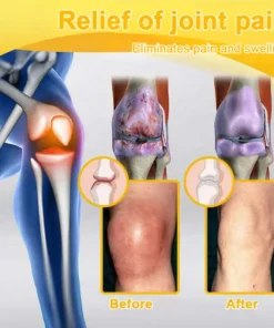 ADFIRE® Bee Venom Pain-Relief Bone Healing Spray