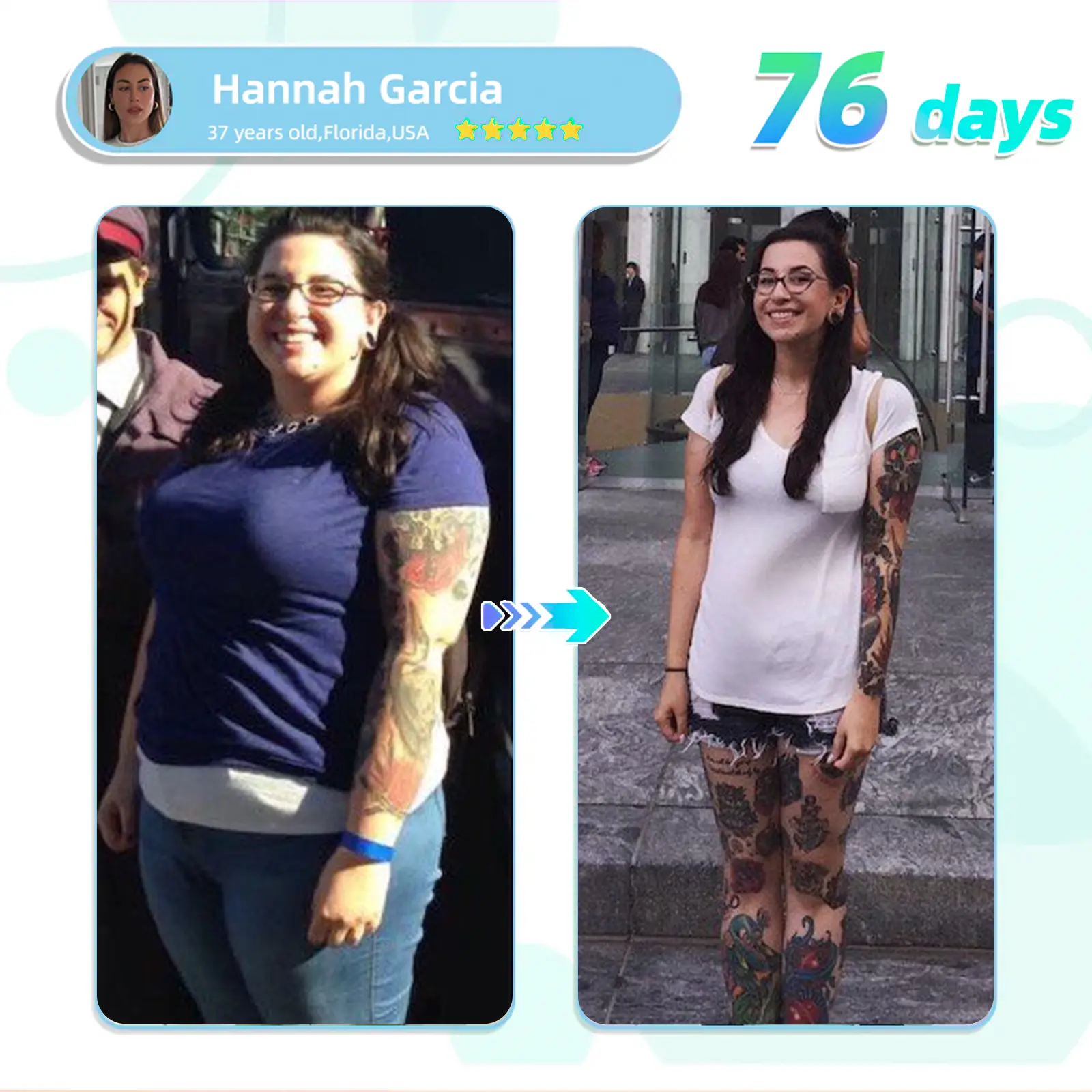 ADFIRE® NIDDK-Tirzepatide Slimming & health NANO MICRONEEDLE PATCH