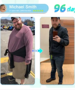 ADFIRE® NIDDK-Tirzepatide Slimming & health NANO MICRONEEDLE PATCH