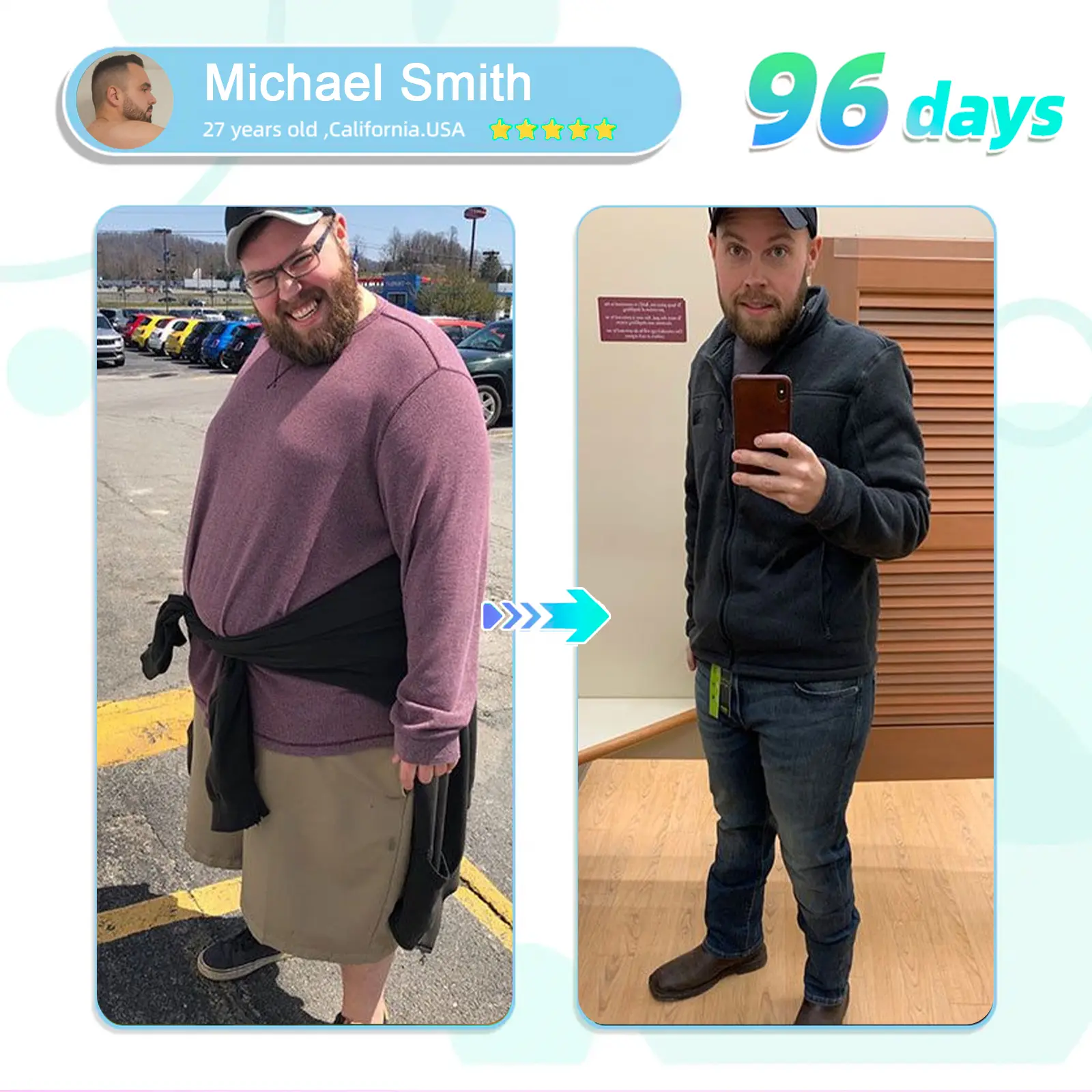 ADFIRE® NIDDK-Tirzepatide Slimming & health NANO MICRONEEDLE PATCH