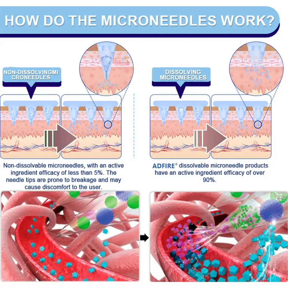 ADFIRE® NIDDK-Tirzepatide Slimming & health NANO MICRONEEDLE PATCH