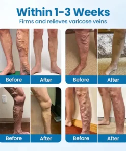 ADFIRE® VeinGuard Herbal Spray