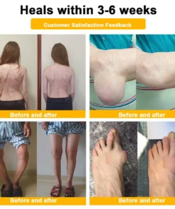 AQA™ Botulinum & Bee Essence Pain-Relief Bone Healing Cream