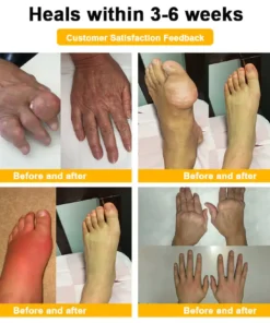 AQA™ Botulinum & Bee Essence Pain-Relief Bone Healing Cream