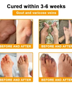 AQA™ Botulinum & Bee Essence Pain-Relief Bone Healing Cream