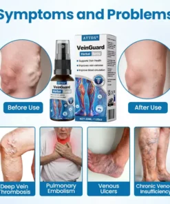 ATTDX® VeinGuard Herbal Spray