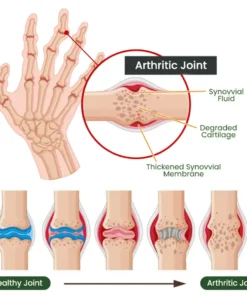 Adfire® Bee Venom Bone & Joint Revive Spray