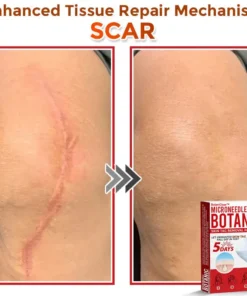 BotaniClear™ USA-Made MicroNeedle Patch for Skin Tags