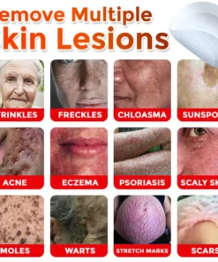 BotaniClear™ USA-Made MicroNeedle Patch for Skin Tags