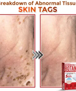 BotaniClear™ USA-Made MicroNeedle Patch for Skin Tags