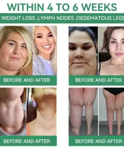 DiSyan® 𝐺𝐿𝑃-1 𝑆𝑙𝑖𝑚𝑚𝑖𝑛𝑔 & 𝐻𝑒𝑎𝑙𝑡ℎ 𝑁𝑎𝑠𝑎𝑙 𝑅𝑖𝑛𝑔