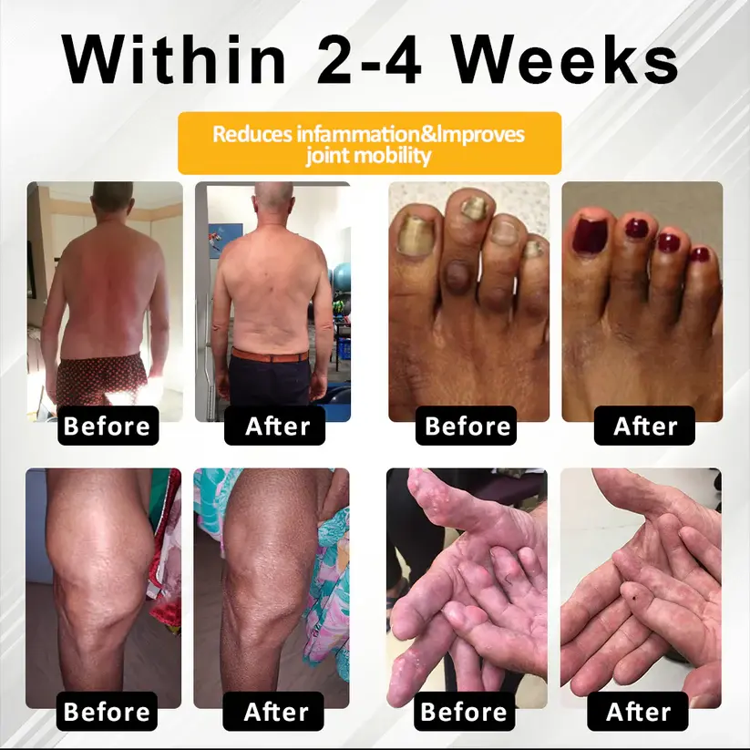 NovaRX® Motion+ Herbal Joint Comfort Balm