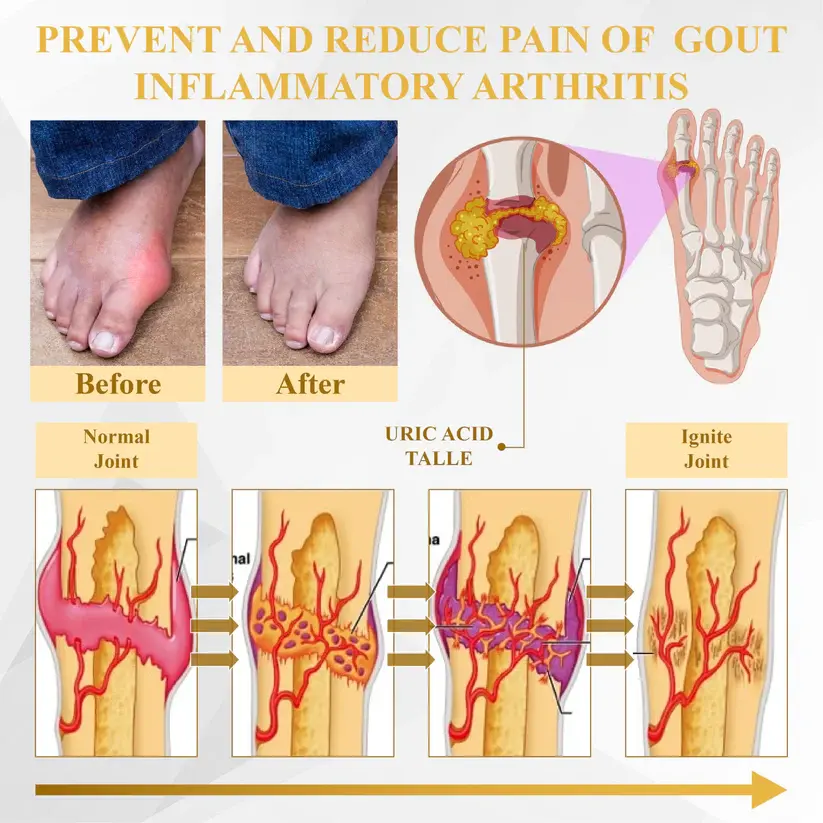NovaRX® Motion+ Herbal Joint Comfort Balm