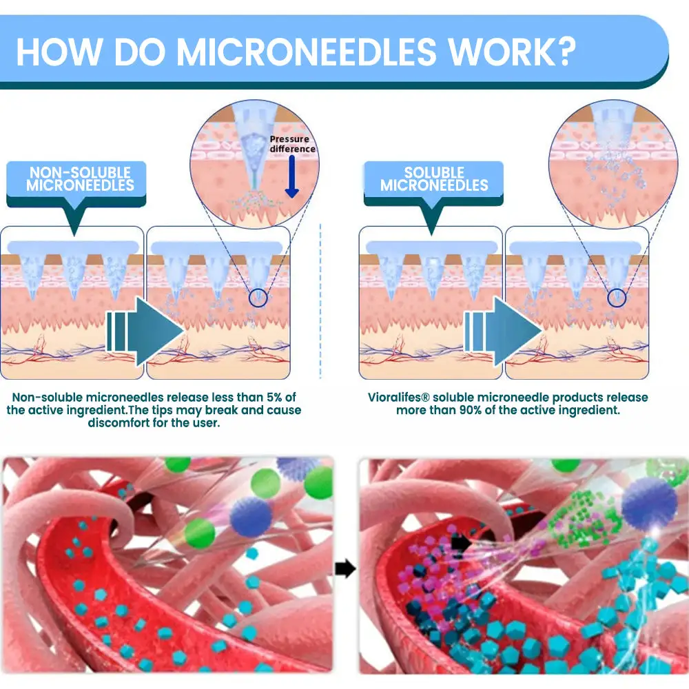 Vioralifes®🍃 NIDDK-Tirzepatide Nano Painless Microneedle Patch