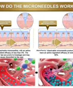 WarmFamily® FDA-Tirzepatide Nano-Microneedle Patch