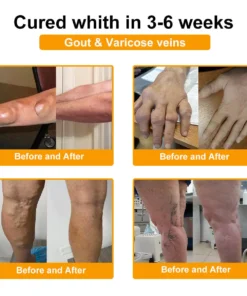 𝐀𝐄𝐄𝐇𝗙𝗘𝗡𝗚® 𝐁𝐨𝐭𝐮𝐥𝐢𝐧𝐮𝐦 𝐓𝐨𝐱𝐢𝐧 & 𝐁𝐞𝐞 𝐕𝐞𝐧𝐨𝐦 𝐒𝐨𝐨𝐭𝐡𝐢𝐧𝐠 𝐏𝐚𝐢𝐧 𝐑𝐞𝐥𝐢𝐞𝐟 𝐌𝐚𝐬𝐬𝐚𝐠𝐞 𝐆𝐞𝐥