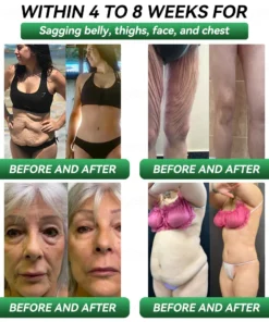 𝐊𝐞𝐲𝐞𝐬𝐬® 𝐆𝐋𝐏-𝟏 & 𝐌𝐚𝐭𝐫𝐢𝐱𝐲𝐥 𝟑𝟎𝟎𝟎 𝐒𝐥𝐢𝐦𝐦𝐢𝐧𝐠 & 𝐇𝐞𝐚𝐥𝐭𝐡 𝐃𝐫𝐨𝐩𝐬