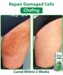 𝐹𝑎𝑡𝑜𝑛𝑔® 𝐹𝑟𝑜𝑔 𝑀𝑢𝑐𝑢𝑠 𝑆𝑘𝑖𝑛 𝑅𝑒𝑝𝑎𝑖𝑟 𝑆𝑝𝑟𝑎𝑦