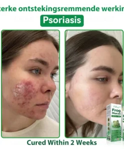 𝐹𝑎𝑡𝑜𝑛𝑔® 𝐹𝑟𝑜𝑔 𝑀𝑢𝑐𝑢𝑠 𝑆𝑘𝑖𝑛 𝑅𝑒𝑝𝑎𝑖𝑟 𝑆𝑝𝑟𝑎𝑦