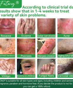 𝐹𝑎𝑡𝑜𝑛𝑔® 𝐹𝑟𝑜𝑔 𝑀𝑢𝑐𝑢𝑠 𝑆𝑘𝑖𝑛 𝑅𝑒𝑝𝑎𝑖𝑟 𝑆𝑝𝑟𝑎𝑦