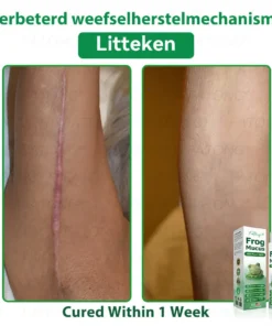 𝐹𝑎𝑡𝑜𝑛𝑔® 𝐹𝑟𝑜𝑔 𝑀𝑢𝑐𝑢𝑠 𝑆𝑘𝑖𝑛 𝑅𝑒𝑝𝑎𝑖𝑟 𝑆𝑝𝑟𝑎𝑦