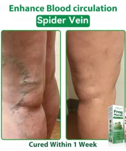 𝐹𝑎𝑡𝑜𝑛𝑔® 𝐹𝑟𝑜𝑔 𝑀𝑢𝑐𝑢𝑠 𝑆𝑘𝑖𝑛 𝑅𝑒𝑝𝑎𝑖𝑟 𝑆𝑝𝑟𝑎𝑦