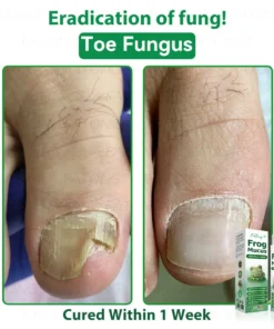 𝐹𝑎𝑡𝑜𝑛𝑔® 𝐹𝑟𝑜𝑔 𝑀𝑢𝑐𝑢𝑠 𝑆𝑘𝑖𝑛 𝑅𝑒𝑝𝑎𝑖𝑟 𝑆𝑝𝑟𝑎𝑦