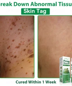 𝐹𝑎𝑡𝑜𝑛𝑔® 𝐹𝑟𝑜𝑔 𝑀𝑢𝑐𝑢𝑠 𝑆𝑘𝑖𝑛 𝑅𝑒𝑝𝑎𝑖𝑟 𝑆𝑝𝑟𝑎𝑦