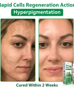 𝐹𝑎𝑡𝑜𝑛𝑔® 𝐹𝑟𝑜𝑔 𝑀𝑢𝑐𝑢𝑠 𝑆𝑘𝑖𝑛 𝑅𝑒𝑝𝑎𝑖𝑟 𝑆𝑝𝑟𝑎𝑦