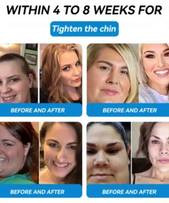 𝐃𝐢𝐚𝐩𝐚𝐬𝐨𝐧® 𝐺𝐿𝑃-1 & 𝑁𝑀𝑁+ 𝑊𝑒𝑖𝑔ℎ𝑡 𝐿𝑜𝑠𝑠 & 𝐵𝑙𝑜𝑜𝑑 𝑆𝑢𝑔𝑎𝑟 𝐶𝑜𝑛𝑡𝑟𝑜𝑙 𝐻𝑖𝑔ℎ𝑙𝑦 𝐸𝑓𝑓𝑒𝑐𝑡𝑖𝑣𝑒 𝑂𝑟𝑎𝑙 𝐿𝑖𝑞𝑢𝑖𝑑