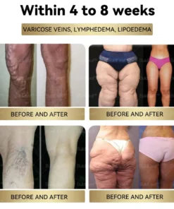 𝑪𝒓𝒂𝒛𝒚𝑳𝒆𝒂𝒇® Tirzepatide 𝗚𝗜𝗣/𝗚𝗟𝗣-𝟭 𝗗𝘂𝗮𝗹-𝗔𝗰𝘁𝗶𝗼𝗻 𝑺𝒍𝒊𝒎𝒎𝒊𝒏𝒈 & 𝑯𝒆𝒂𝒍𝒕𝒉 𝑩𝒐𝒐𝒔𝒕 𝑫𝒓𝒐𝒑𝒔