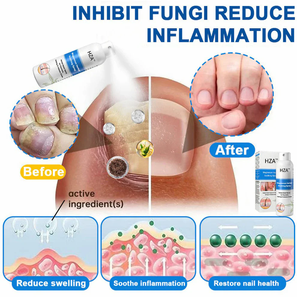 HZA™ Magnesium Herbal Psoriasis Spray - Image 4