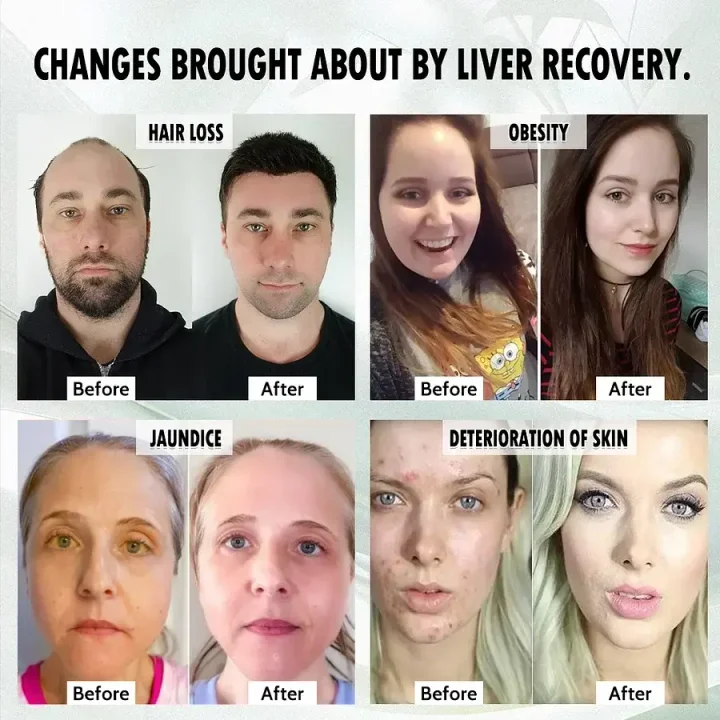 LiverPlus® FGF21 Liver Support Weight Loss Oral Solution - Image 3