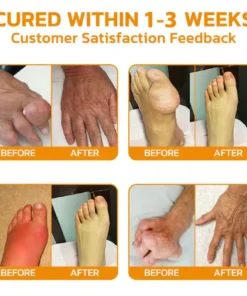 AQA™ Botulinum and Bee Toxin Pain Relief Bone Healing Cream