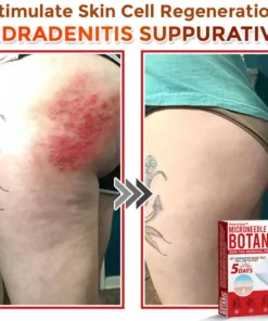 BotaniClear™ USA-Made MicroNeedle Patch for Skin Tags