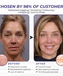 Brightmarsh® ElastaPro Emu Oil Skin Firming Cream